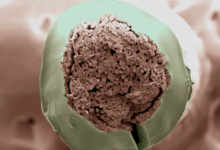 Next Generation Surgical Sutures Inspired by Human Tendons